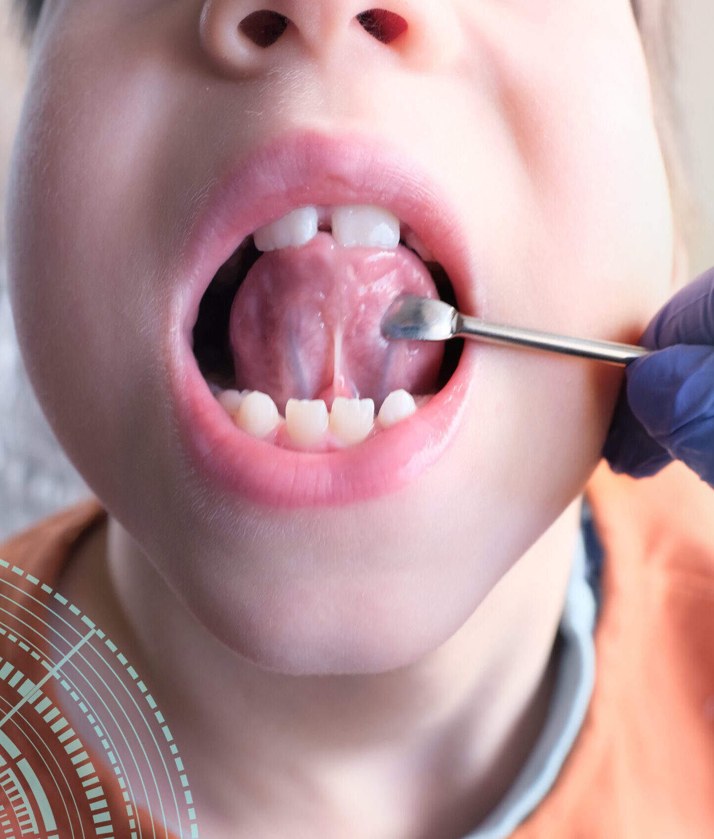 dentist, doctor examines oral cavity of small patient, length of frenum of the tongue, boy, kid performs articulation exercises for mouth, concept of speech disorders, correction